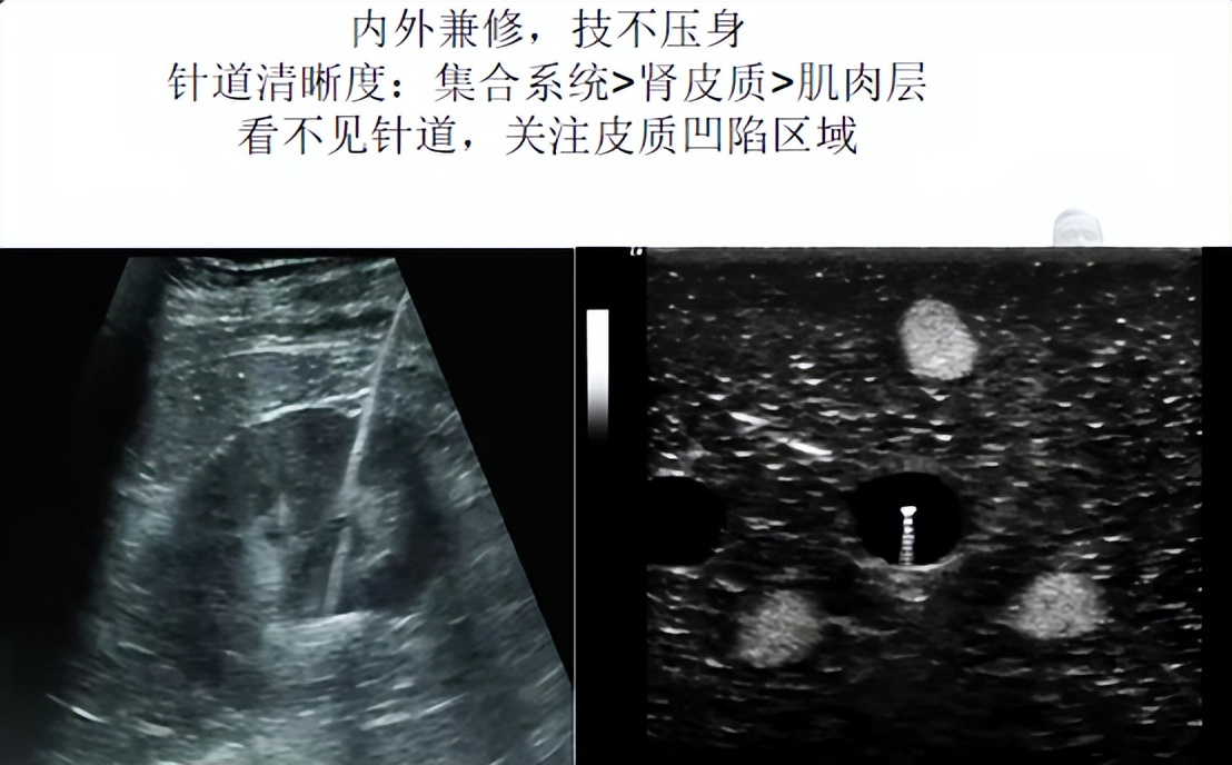 明知山有虎偏向虎山行神评论,明知山有虎偏向虎山行打一生肖