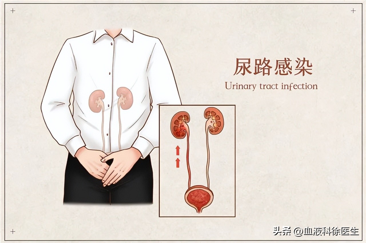 体检出肾结石怎么去医院问诊,体检检查出肾结石怎么处理