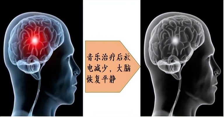 听治耳鸣音乐,耳鸣诊疗音乐