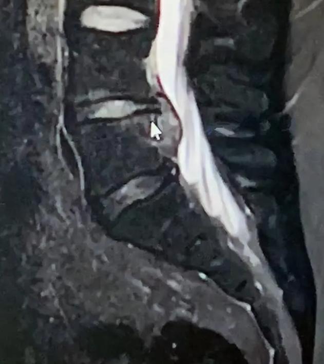 辅导作业爸爸被气,辅导作业被气死的爸爸后续