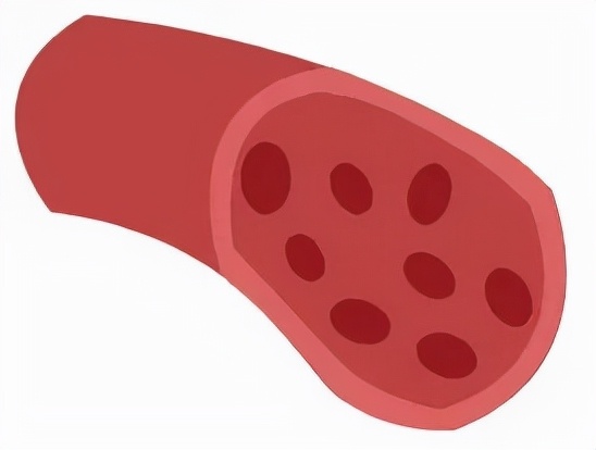 肝病出现脚肿脸肿还能活多久,肝病患者全身浮肿痒