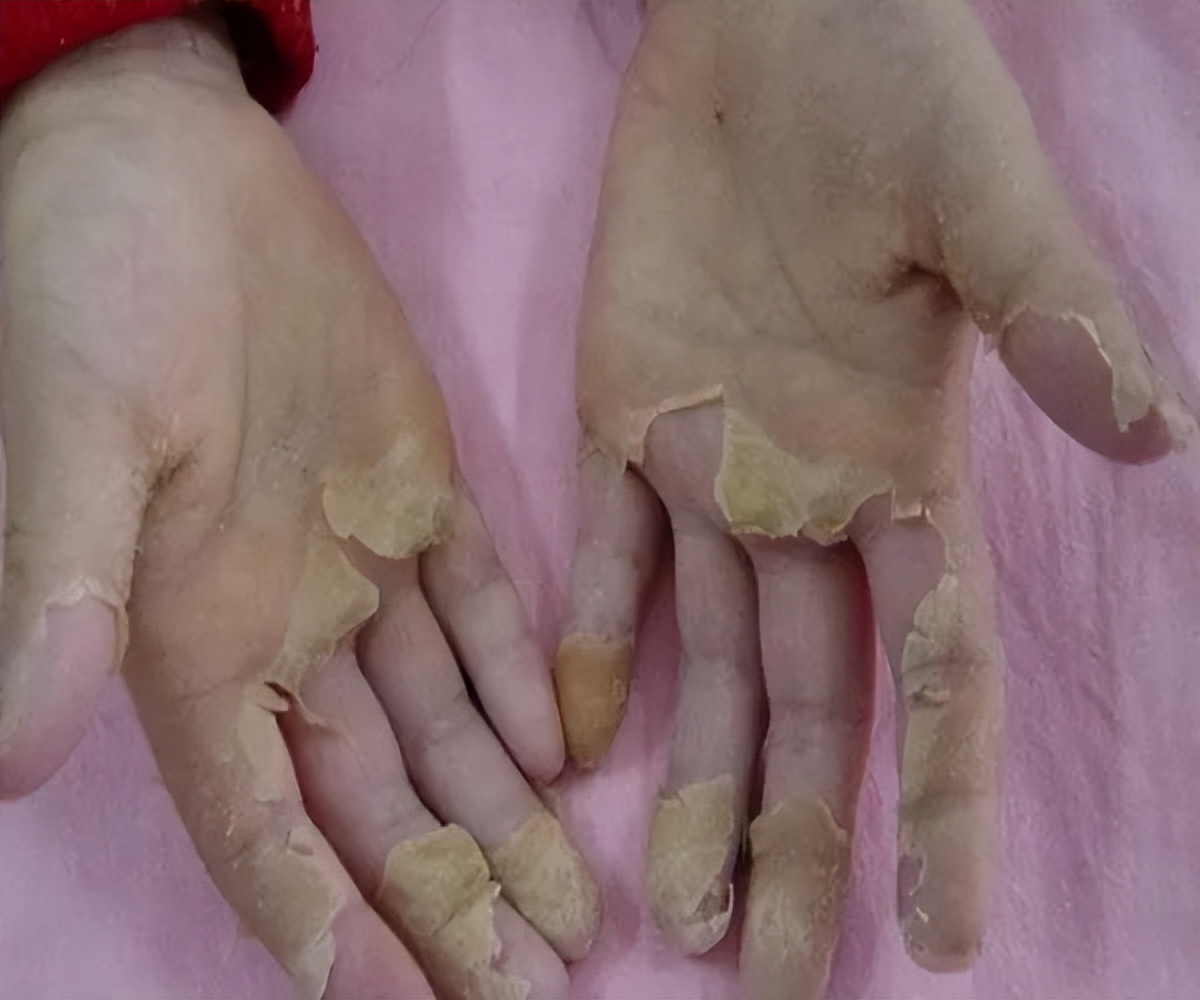 小孩的舌头出现小红点点,小儿舌头的各种症状如何解决