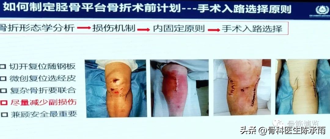 国家卫健委主办的骨创伤专项能力培训项目----下肢损伤学习班