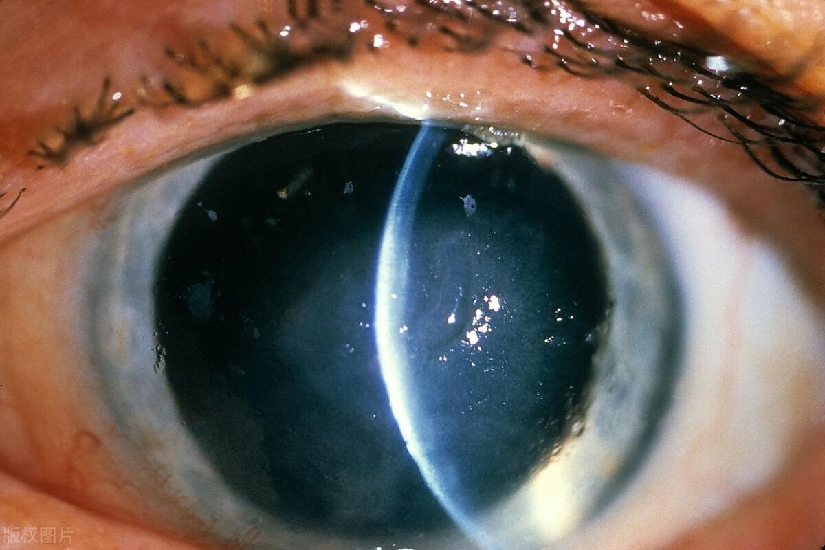 你不知道的眼科医院那些事,你不知道的美睫小知识