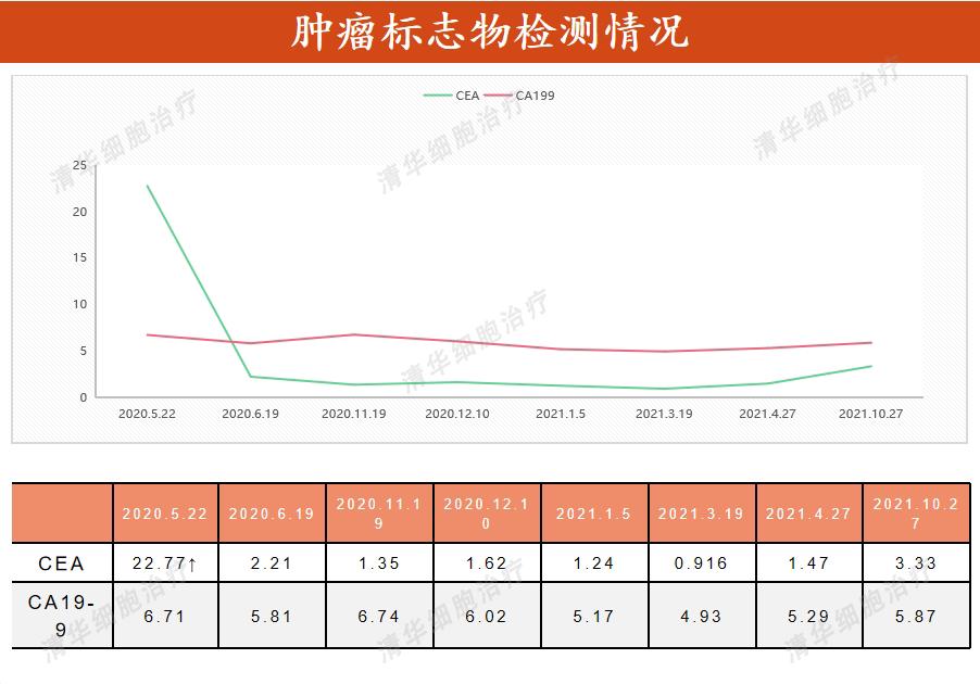 确诊肠癌了该怎么办,确诊癌症先别绝望
