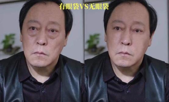 怎样区分卧蚕和眼袋最简单的方法,如何区别眼袋和卧蚕