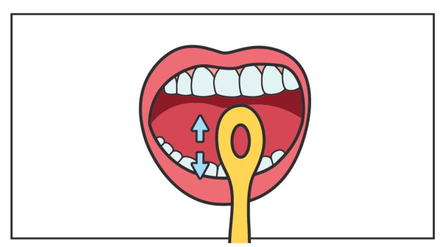 5岁小孩积食有口臭食物调理,含b族维生素的食物能去口臭吗