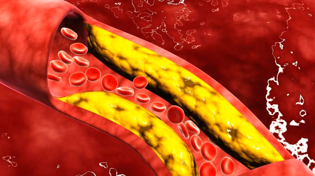 “50岁了，还能去献血浆吗？会不会对身体有影响？”