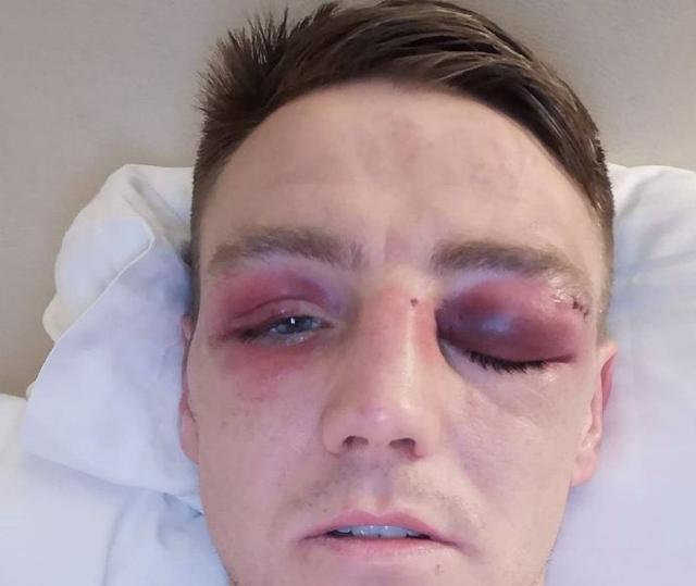 金价暴跌国际金价,金价暴跌场面