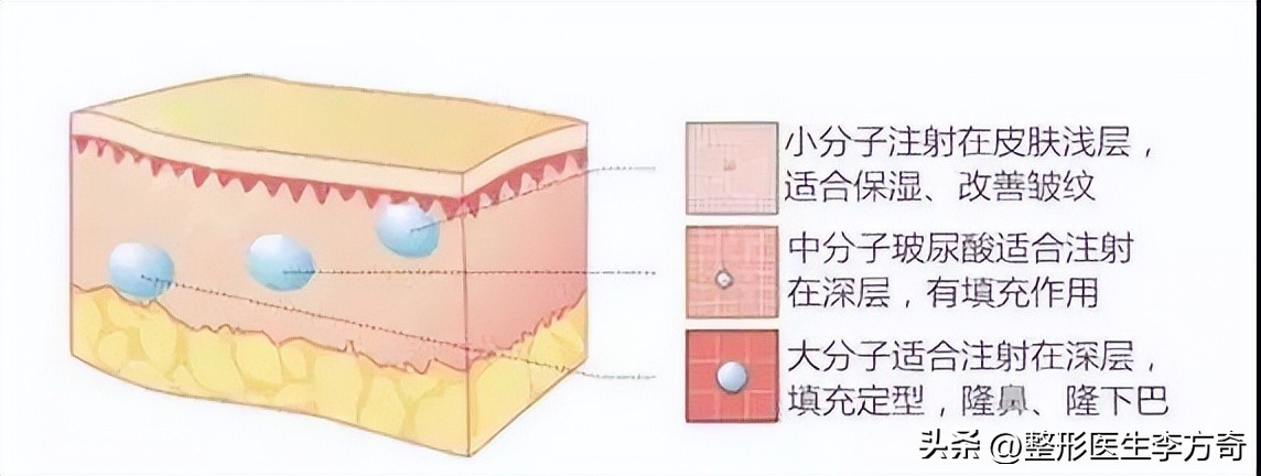 女明星爱美丽化妆品怎么样,玻尿酸功效与作用护肤