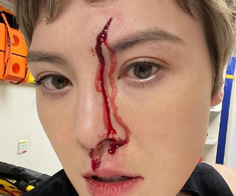 31岁知名女明星出车祸,31岁女演员车祸