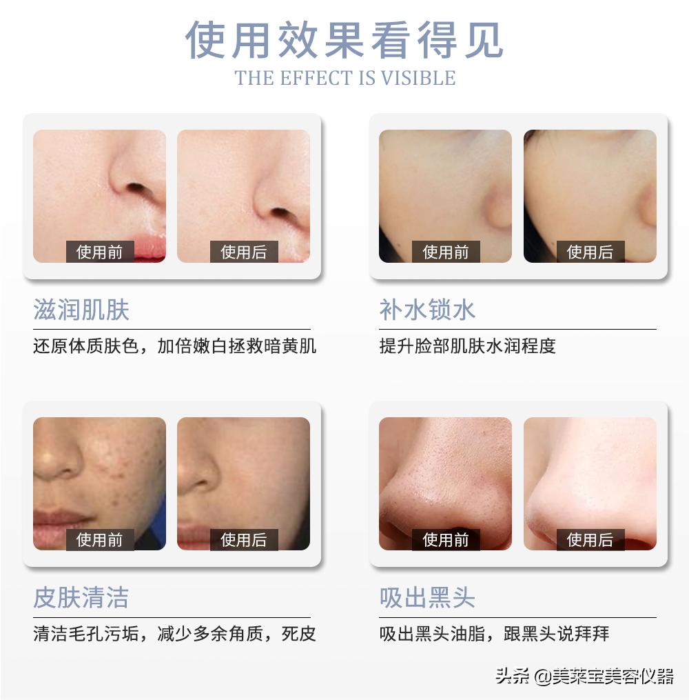 皮肤管理中心仪器选什么好,皮肤管理中心要哪些设备