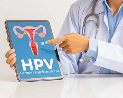 崩溃！57岁杭州女士连续三年发现HPV阳性戴套能不能百分百阻隔？感染后接种疫苗有用吗？