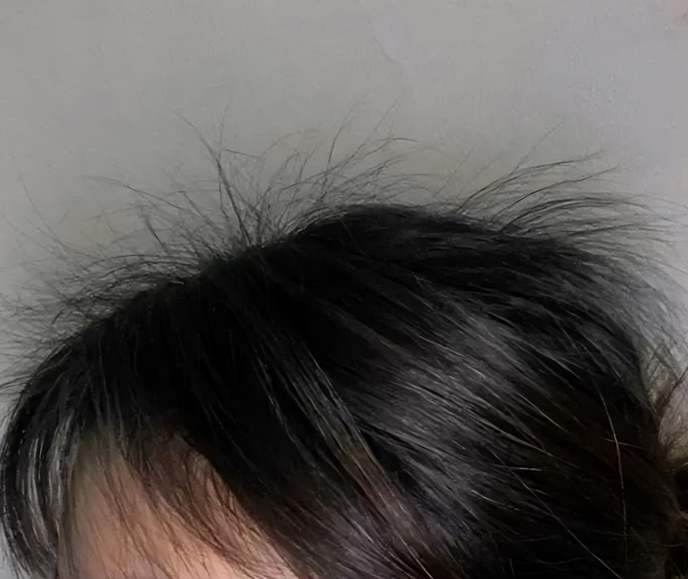 生发育发液专业测评,最有效的防脱发育发液真实测评