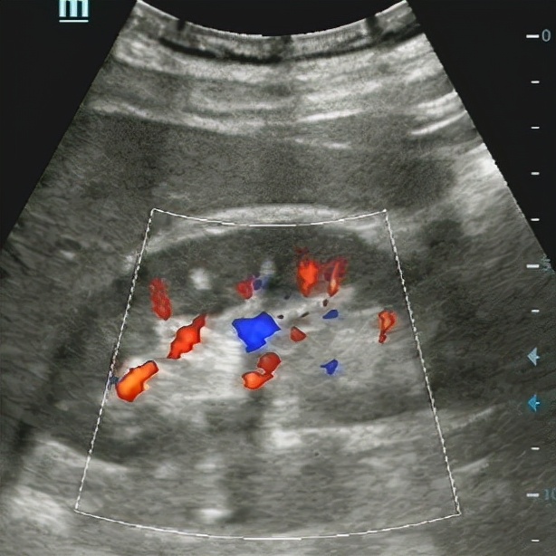 八十岁老爷爷小便尿不出来,85岁老人小便拉不出来是怎么回事