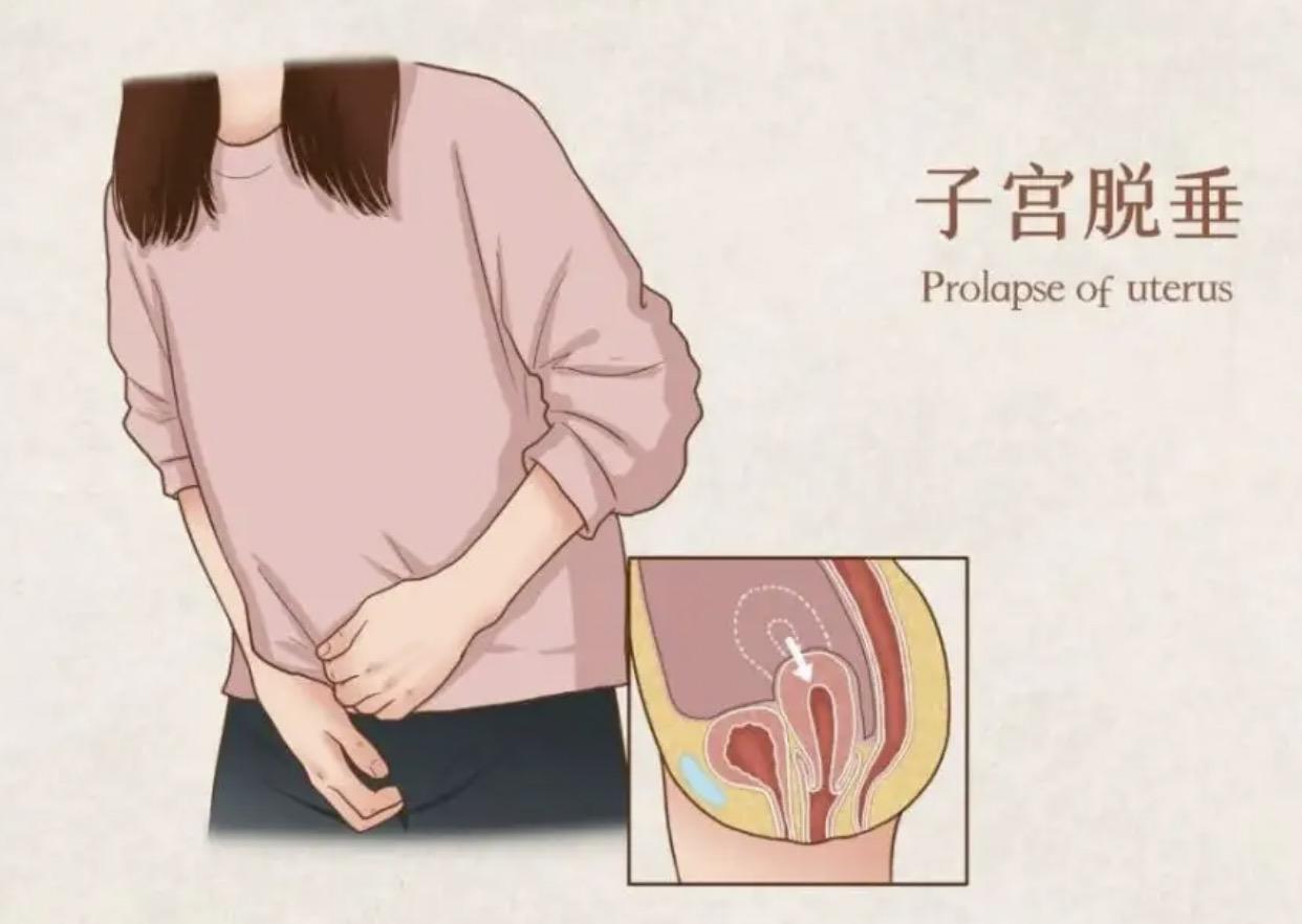 痛苦的疾病治疗,妇科疾病有没有完全治愈的