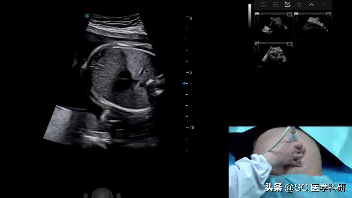 软骨发育不良宝宝能长高吗,孩子想长高吃什么有助软骨生长