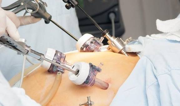 得了子宫肌瘤好怕怎么办,得了子宫肌瘤做什么手术