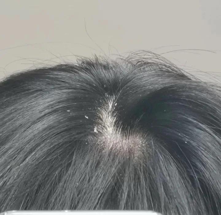 老瑶姜洗发水是智商税吗,洗发水的好坏之分哪种洗发水好用