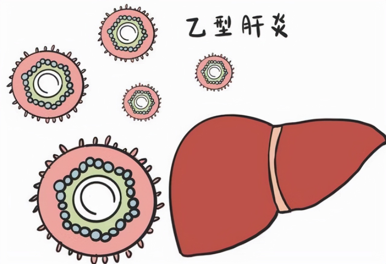 乙肝不能吃哪些肉,乙肝不能吃发物