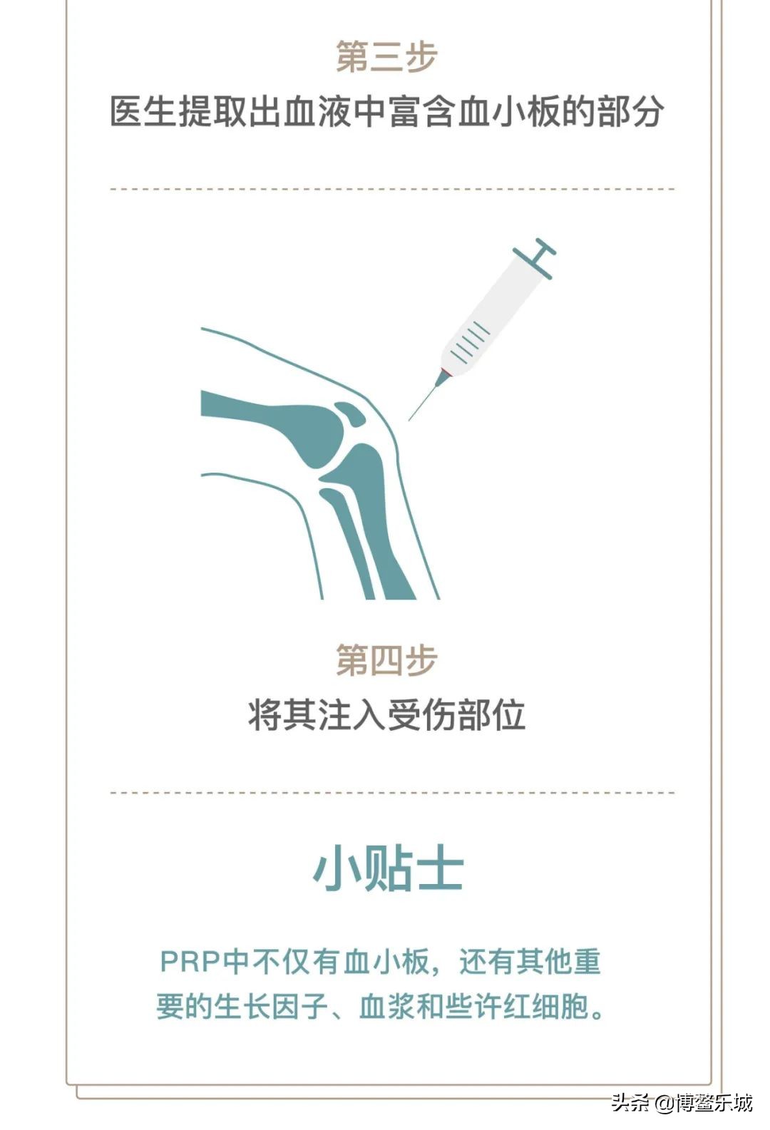 无需手术，乐城颖奕PRP注射治疗让深受膝关节炎苦痛多年的患者告别了轮椅……