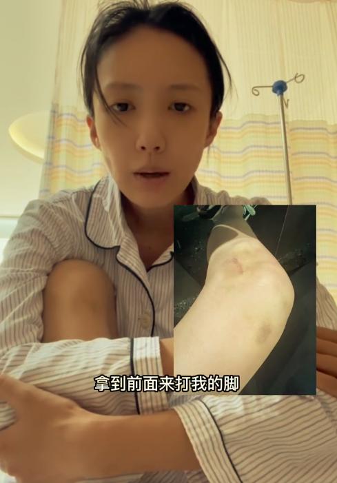 顶流明星整容，男星妻子被婆家虐待，除了汪小菲，这四个瓜也精彩