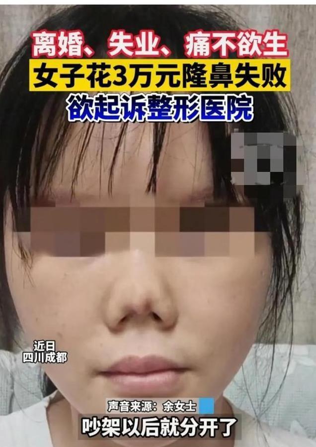 整容朝天鼻成功案例,朝天鼻整容失败案例