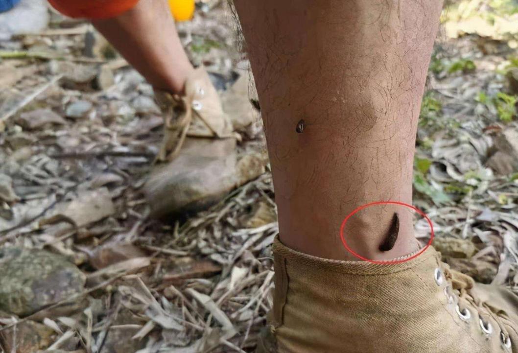 将水蛭放入冰箱还能活,水蛭吸血能钻到人体内并存活吗