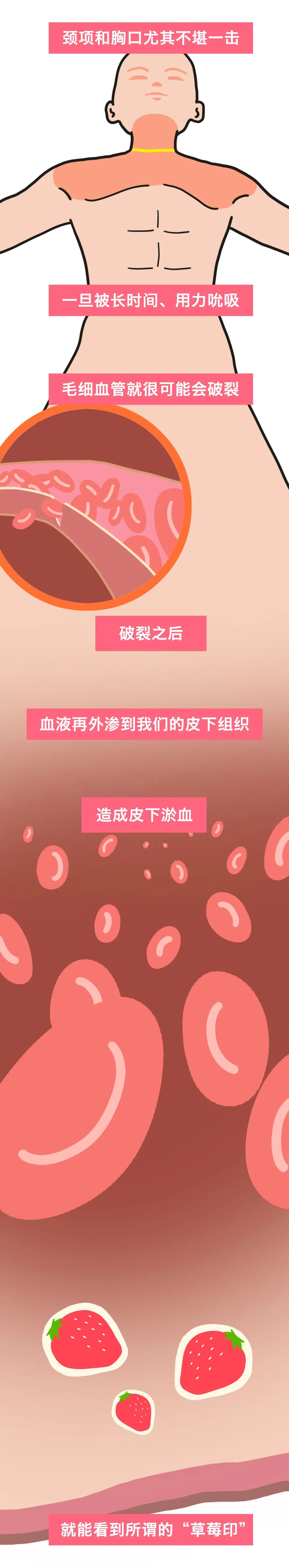 为什么男生喜欢在女生脖子上种草莓？