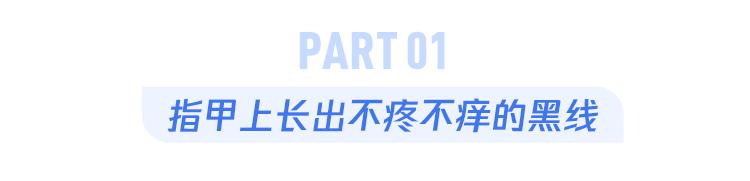 指甲上有黑线的预兆,指甲上有小黑线要注意哪些