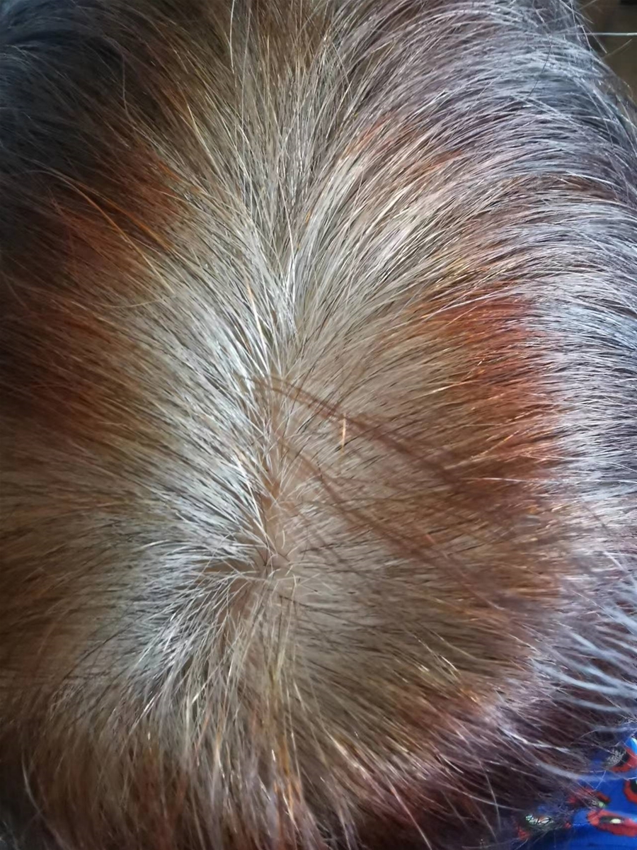 海娜粉把白发染成红色怎么办,哪种海娜粉染白发最好