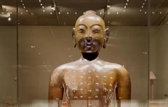 日本针灸铜人,日本古代铜人针灸