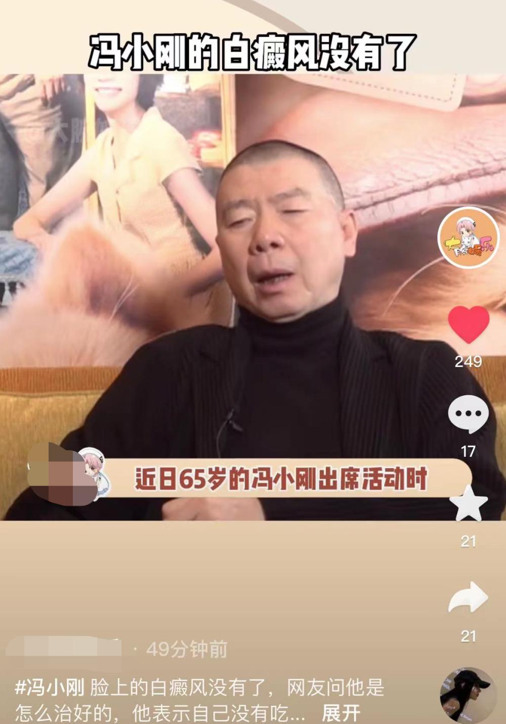 冯小刚白癜风多长时间治愈的,冯小刚的白癜风为什么治不好