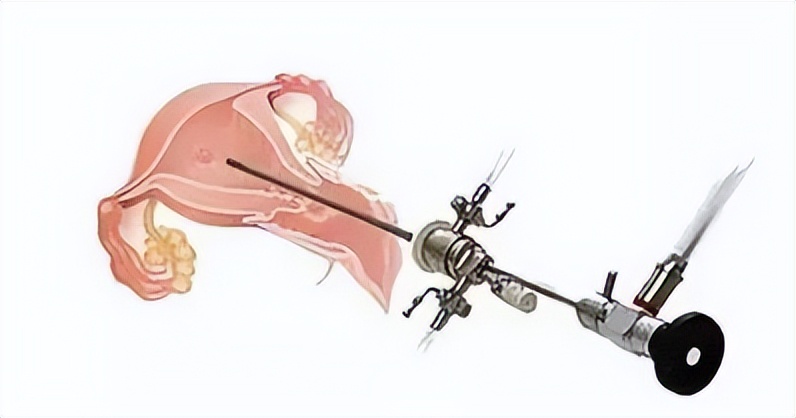 全国肿瘤防治宣传周原发性骨肿瘤,妇科肿瘤防控指南