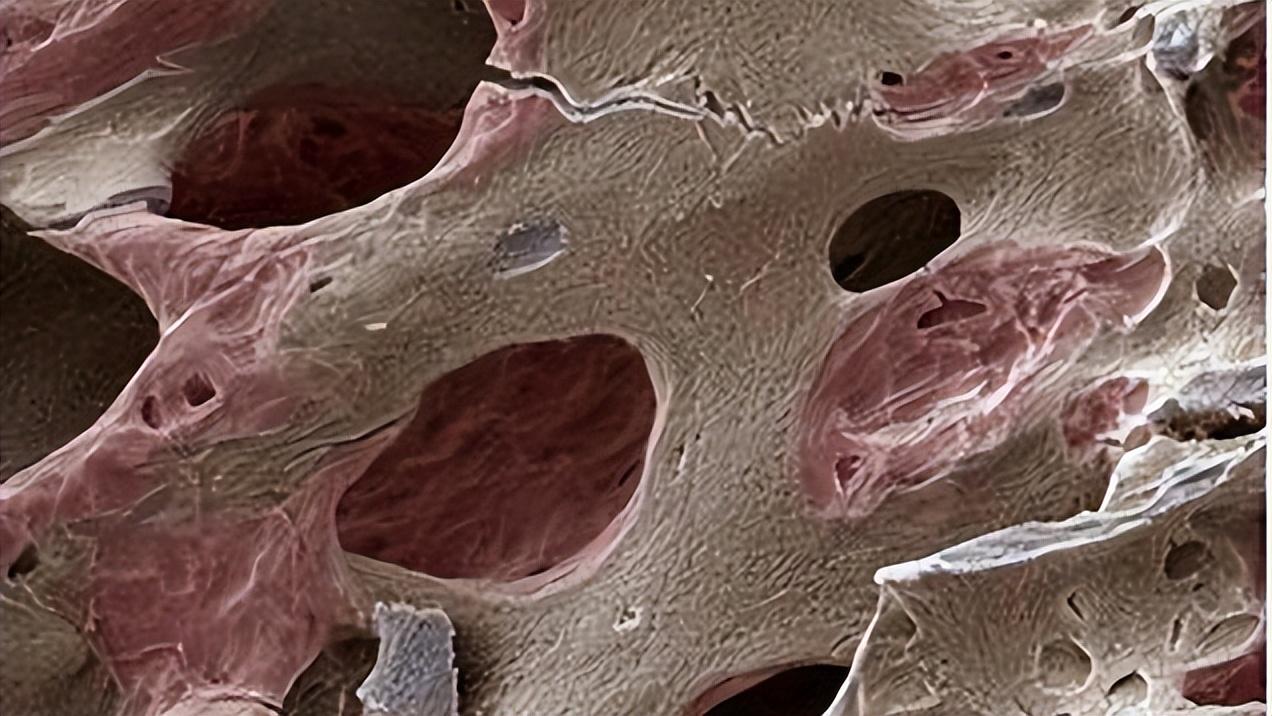 50多岁头老是痛是癌症吗,70岁妇女背后有时有痛感是癌症吗