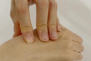 头皮发痒头屑多如何见效快,头皮发痒头屑多有什么好办法