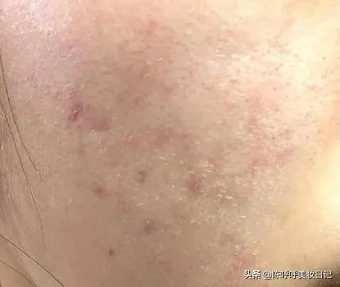 精华油和精华液还有精华水的区别,精华油和精华液用在哪个步骤最佳