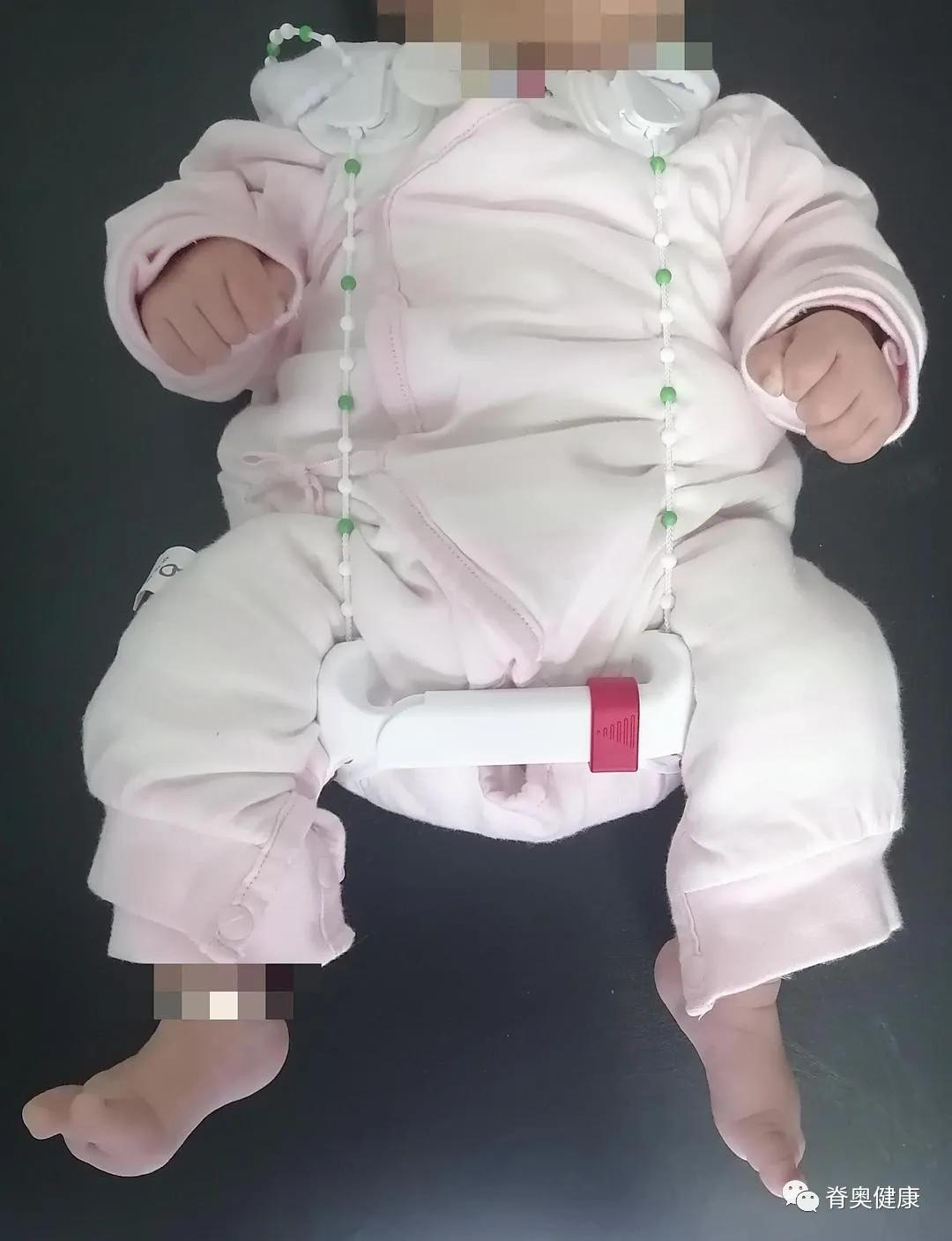 脊奥健康｜婴幼儿矫正案例—先天性髋关节发育不良+Tübingen支具