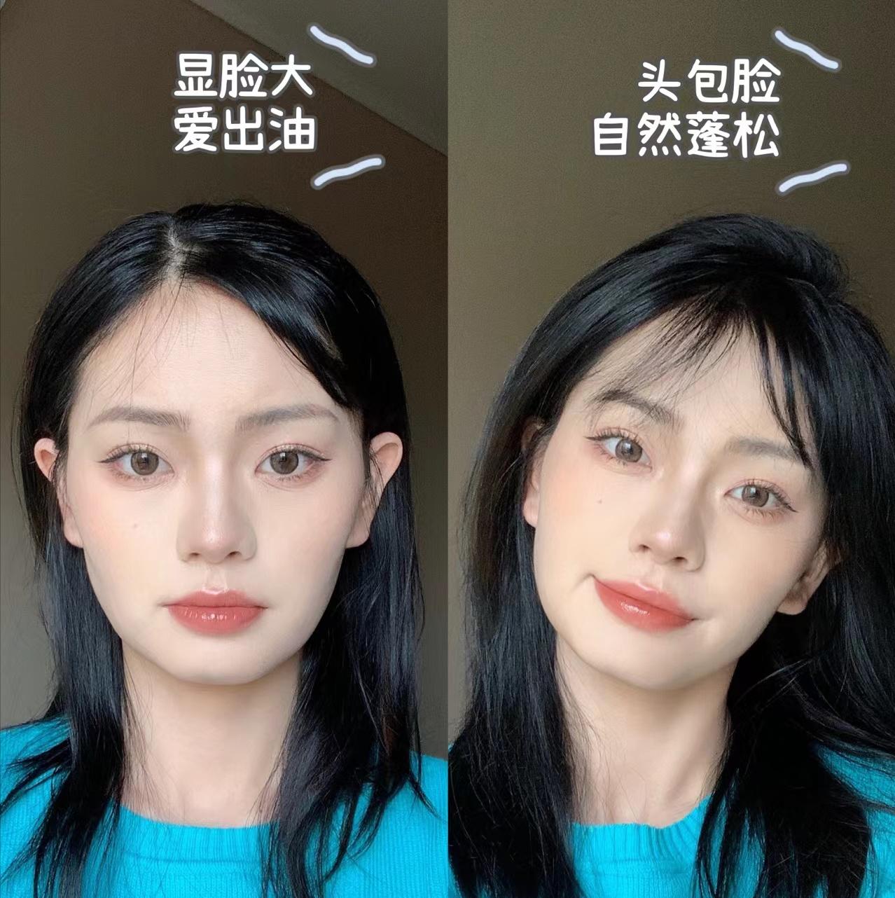 哪些因素会导致秃发,怎样可以停止斑秃继续掉发