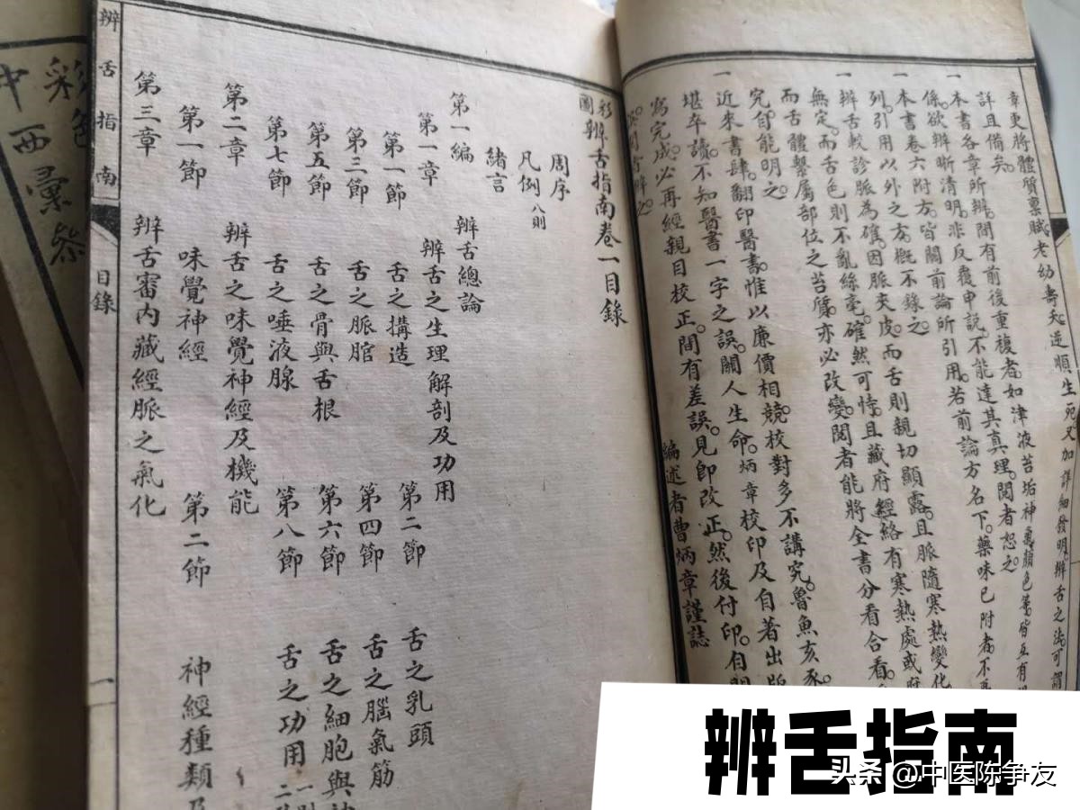 痰湿重的舌象以及症状,胖大舌有齿痕湿气重如何吃中药