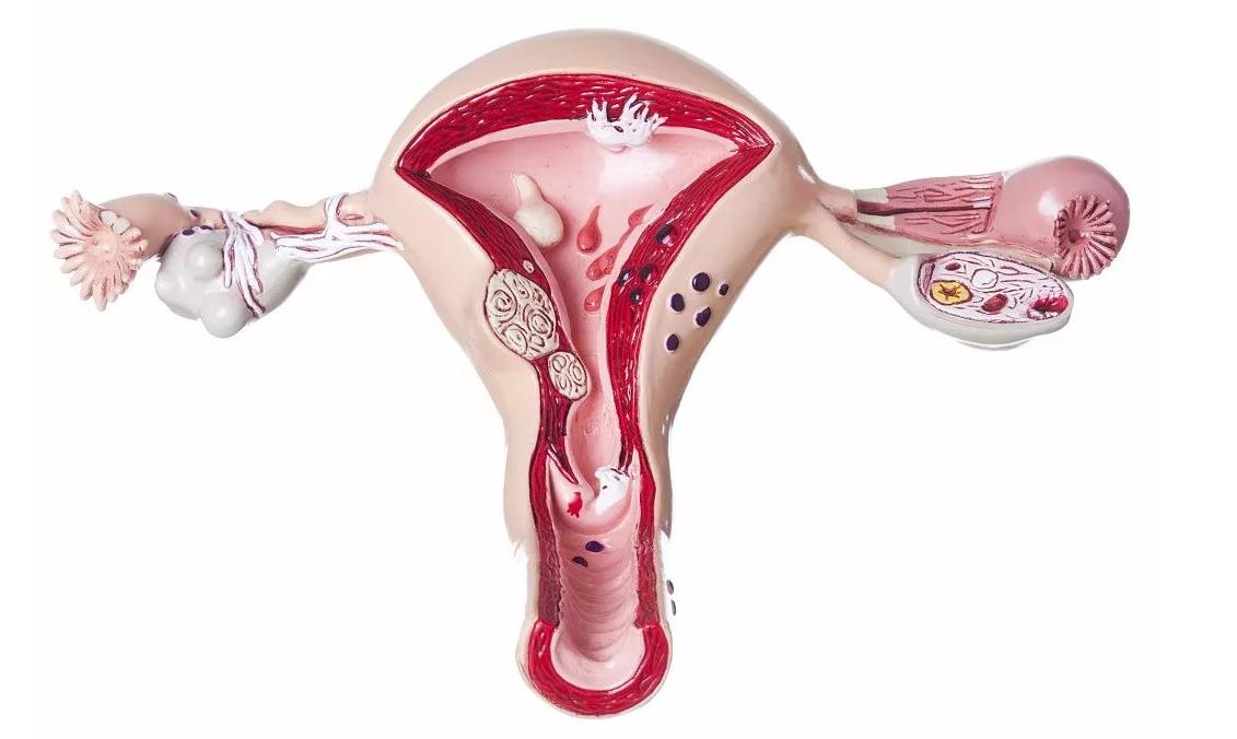 没有子宫的女人，和正常女性有什么不同？2个变化，可能无法改变