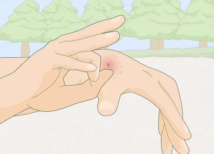 假如你被这么多蜜蜂蛰了怎么办呢,你敢相信被蜜蜂活活蛰死吗