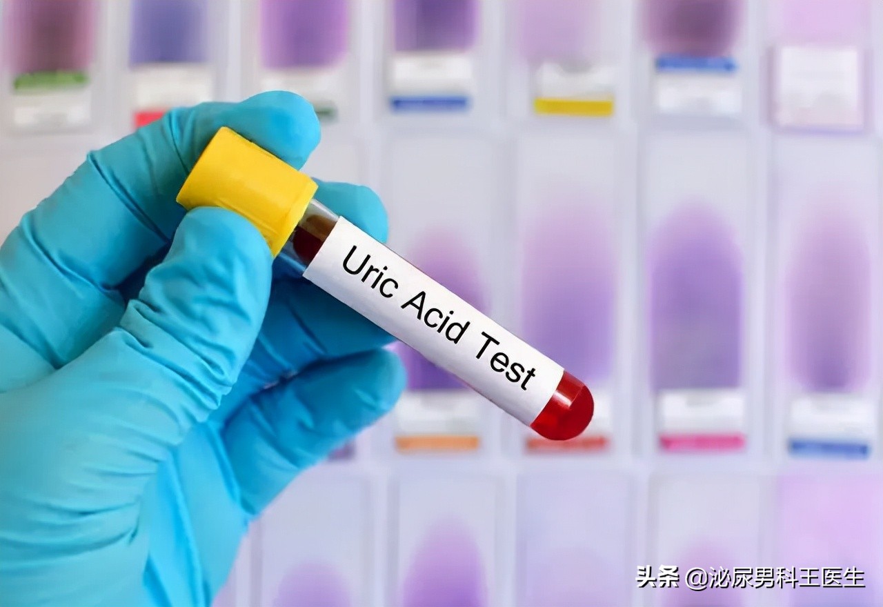 尿酸过高怎么能快速排出尿酸,尿酸高如何排出