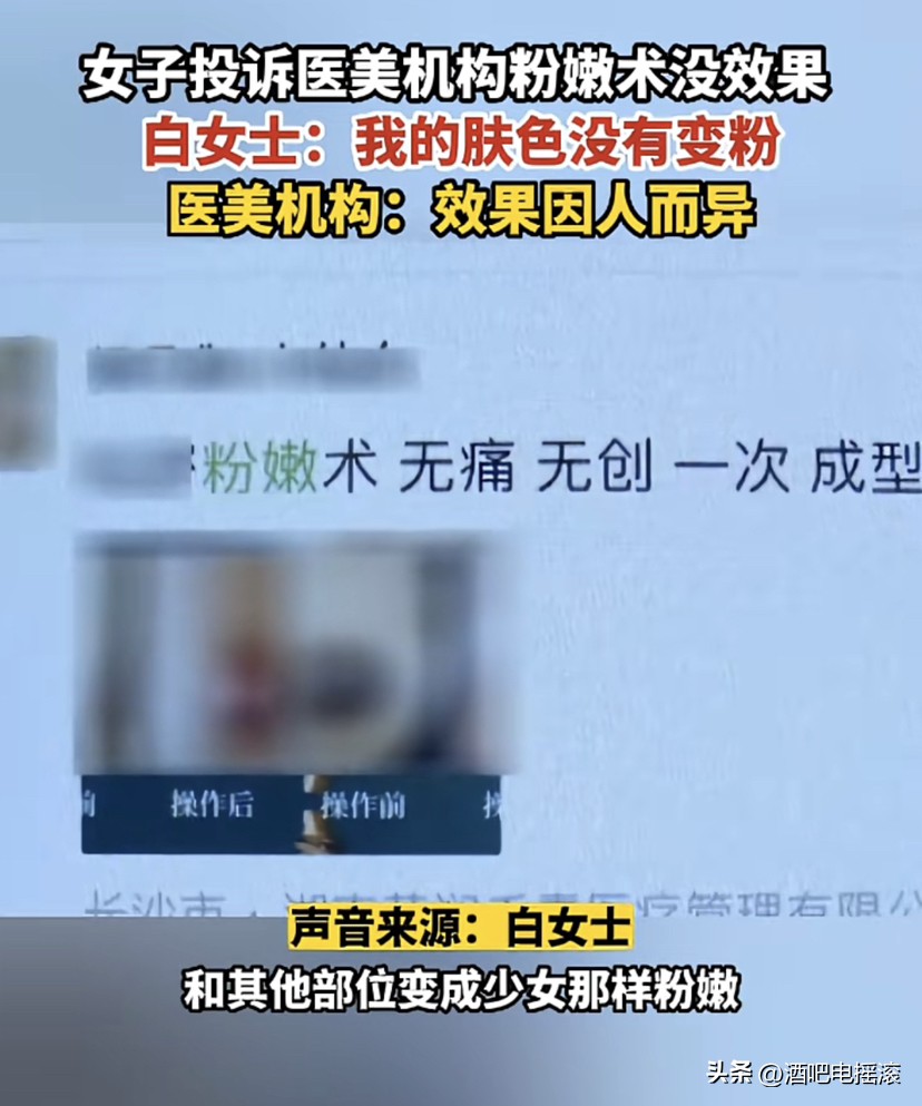 女子投诉医美粉嫩术没效果,医美粉嫩术多少钱