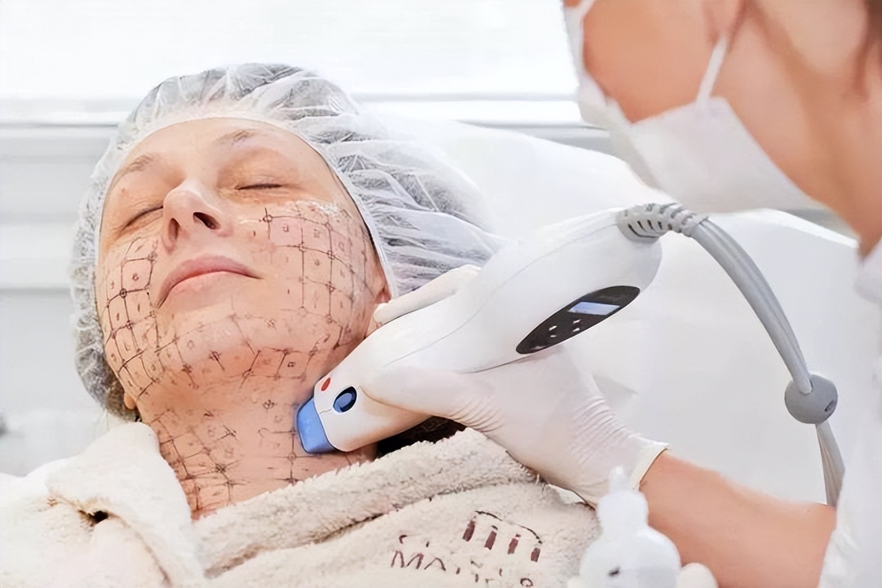 热玛吉从什么时候开始流行的,热玛吉适合哪种肌肤