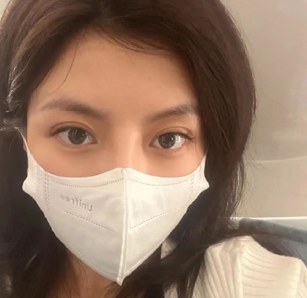 开外眼角优点和缺点,外眼角开的不明显还可以再开吗