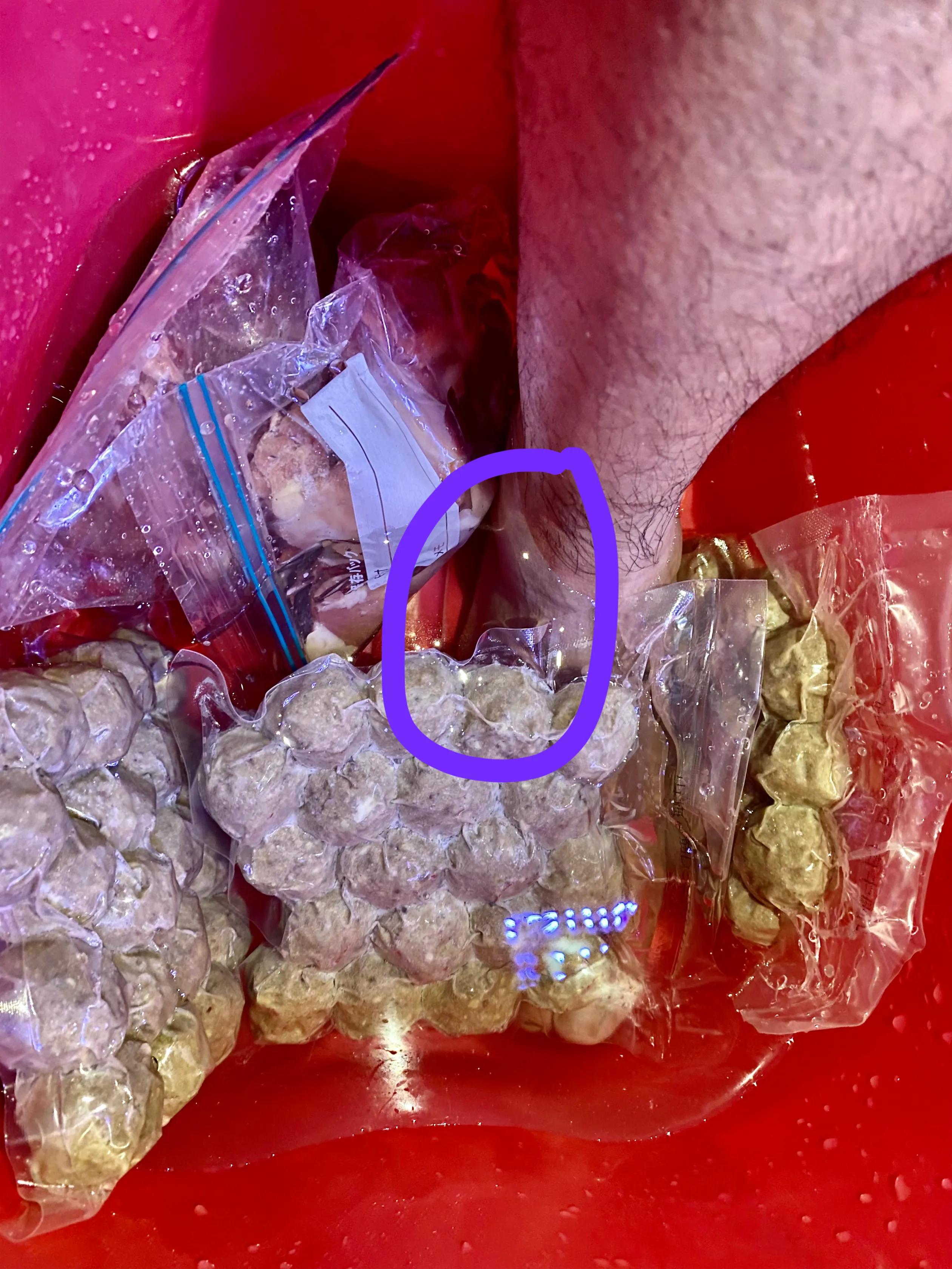 崴脚怎么知道复位了,崴脚别慌4招教你快速康复