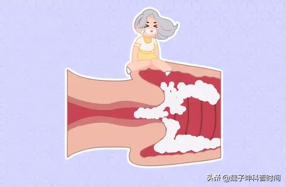 什么?那里有孢子