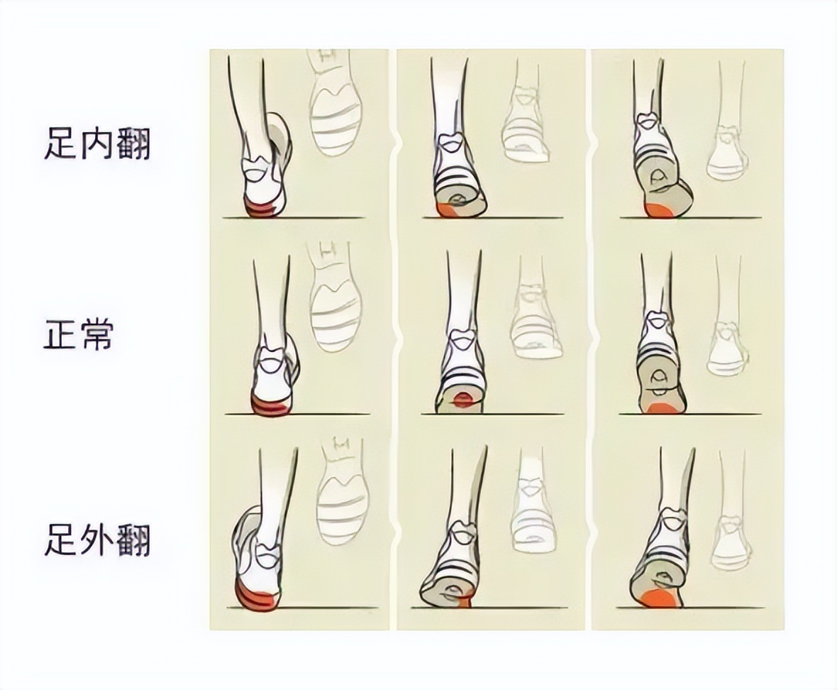 孩子走路姿势不对形象图,孩子走路姿势太丑要不要纠正