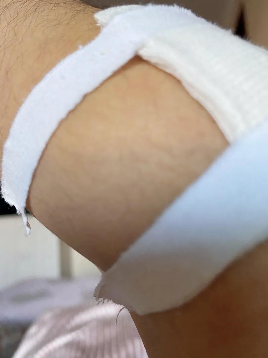 我的“网球肘”之二